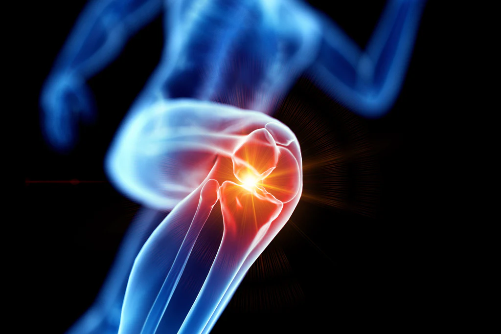 Joint Collax®: Rebuilding Cartilage for Better Joint Function